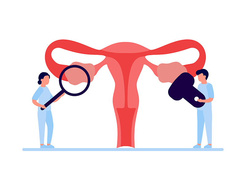 Причины возникновения кисты яичника Причины возникновения кисты яичника, фото