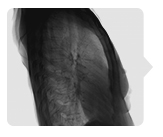 Обзорная рентгенограмма грудной клетки